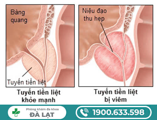 Hình ảnh minh họa